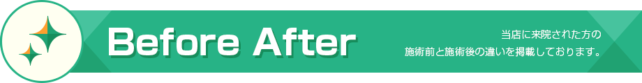 Before After